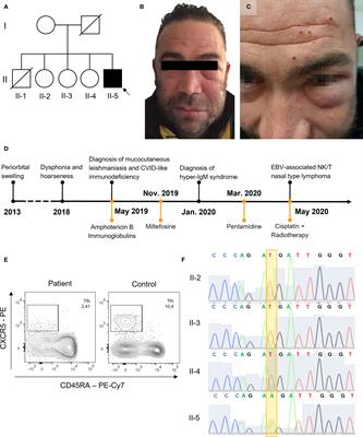 Variants Disrupting CD40L Transmembrane Domain and Atypical X-Linked Hyper-IgM Syndrome: A Case Report With Leishmaniasis and Review of the Literature